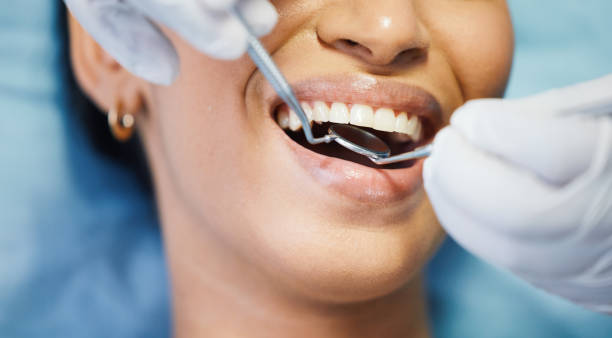 Best Emergency Dental Services for Seniors in James Island, SC