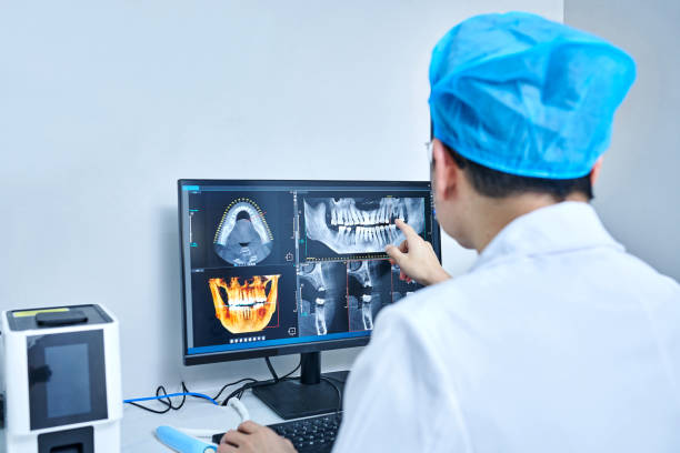 Best Emergency Dental Extractions in James Island, SC